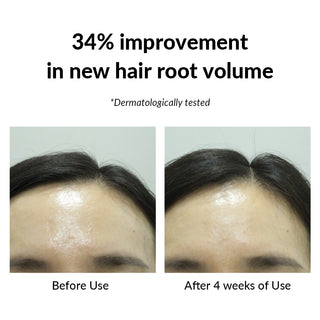 BOTANICSENS Ph.D. REGEN FORMULA Deep Rooted Scalp Tonic