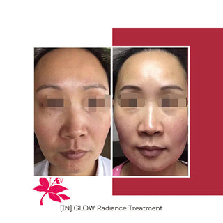 FLORÊVE [IN] GLOW Radiance Cure supplement