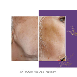 FLORÊVE [IN] YOUTH Anti-Aging Cure