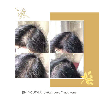 FLORÊVE [IN] YOUTH Anti-Hair Loss Cure